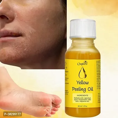 Yellow Peeling Oil Extra Strength For Body-thumb3