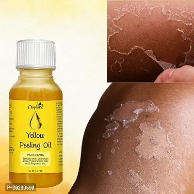 White skin Care peeling oil for Daily Face Care-thumb0