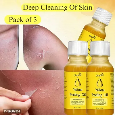 Peeling Oil for Yellow Dark Skin, Peeling Solution Men  Women