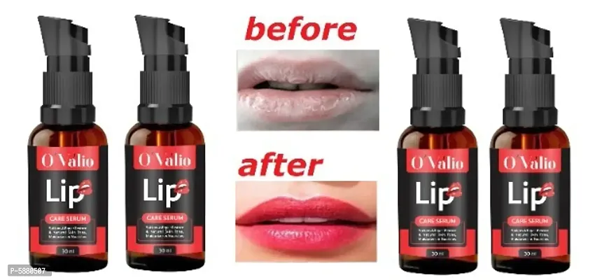 Ovalio Premium Lip Serum For Men And Women (50ml) Pack Of 4