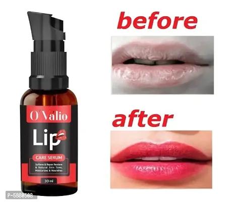 Ovalio Premium Lip Serum For Men And Women (50ml) Pack Of 1