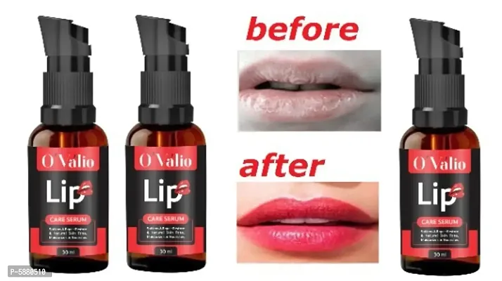 Ovalio Premium Lip Serum For Men And Women (50ml) Pack Of 3