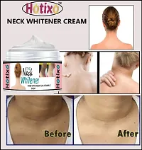 Neck Whitener Cream 50 gm Pack OF-1-thumb1