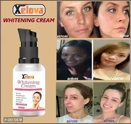 Xelova Whitening Body Lotion On Skin Lighten And Sunscreen Lotion And Brightening Body Lotion Cream For Women And Men 30 Ml With Whitening Cream-thumb0