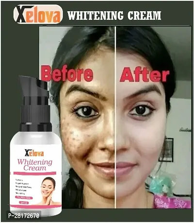 Xelova Whitening Body Lotion On Skin Lighten And Sunscreen Lotion And Brightening Body Lotion Cream For Women And Men 30 Ml With Whitening Cream-thumb2