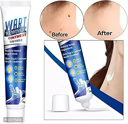 Warts Remover Ointment Wart Treatment Cream Skin Tag Remover Herbal Extract (PACK OF 1)-thumb3