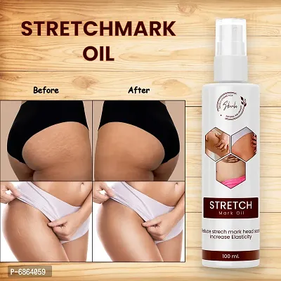 SKIVILA Stretch Marks Scar removal oil during after pregnancy delivery women Even Out Skin Tone Organic Bio Oil for to remove Hyperpigmentation,anti Cellulite,remover scars,No Parabens, Silicones, Mi-thumb3