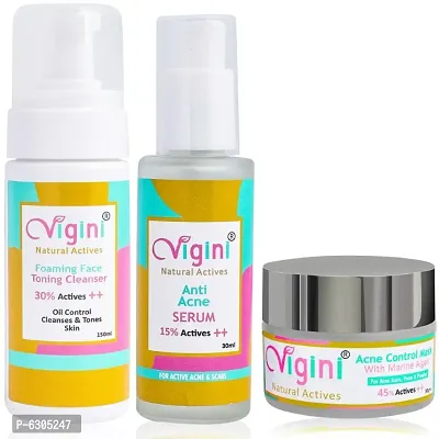 Vigini Natural Anti Acne Foaming Toning Cleansing Wash + Face Serum + Marine Algae Clay Mask Control Oil and Sebum Pimples Removal Prone Skin Unclog Pores