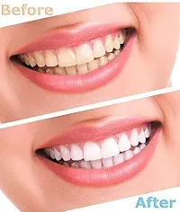 Be Sure Tooth Polisher Whitener Stain Remover with LED Light Luma Smile Rubber Cups Teeth whitening Products-thumb1