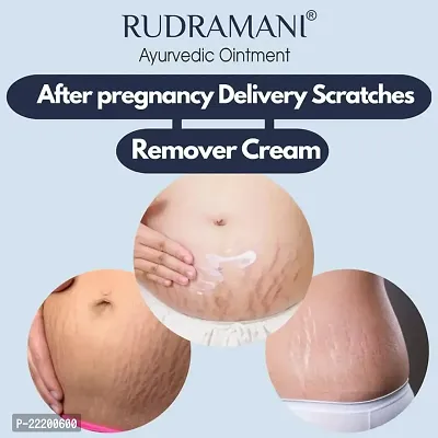 RUDRAMANI Ayurvedic Malam (Cream) for Anti-Fungal Infection, Itching  Skin Recovery for All Skin Types 25gm (Pack of 2)-thumb5