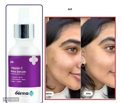 The Derma Co 10% Niacinamide Face Serum For Acne Marks And Acne Prone Skin For Men and Women - 30 ml (dermaco) Face Oil  Serums 30% OFF M.R.P ( Pack Off 1)-thumb0