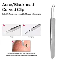 Lele Blackhead Acne Removal Needle Kit 5Pcs with storage box Cleaning Tool Blemish Pimple Comedone for Women and Men-thumb4