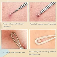 Lele Blackhead Remover Pimple Popper Tool Kit, 5 Pack Professional Comedones Extractor Acne Removal Kit for Blemishs, Whitehead Popping, Zit Removing for Nose Face - with solid Leather Case-thumb2