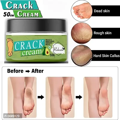 Rabenda Foot Care Cream For Rough, Dry And Cracked Heel Feet Cream For Heel Repair  Healing and Softening Cream  (50 Gm.) Pack Of 1-thumb0