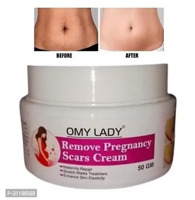 Omy Lady Remove Pregnancy Scars Cream-thumb0