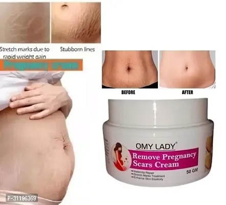 Omy Lady Remove Pregnancy Scars Cream-thumb0