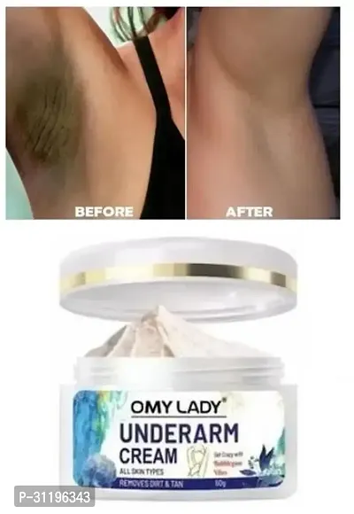 Omy Lady Underarm Cream, Remove Dirt  Tan