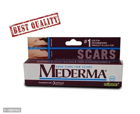 #MEDERMA SKIN SCAR CARE CREAM 10G FOR STRECH MARKS \ ACNE MARKS FREE SKIN _01-thumb0