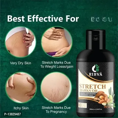 RIBVA present Stretch Marks Removal Oil - Natural Heal Pregnancy, Hip, Legs, Mark oil 100 ml pack of 1-thumb2