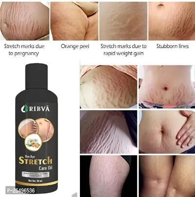 RIBVA present Stretch Marks Removal Oil - Natural Heal Pregnancy, Hip, Legs, Mark oil 50 ml