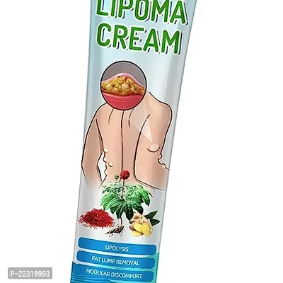 60 gm Lipoma Removal Cream, Lipoma Removal Cream Ointment, Lipoma Elimination Cream, for Lipoma Treatment Cellulite Removal Cream, Anti-Swelling Lymphatic Detox Ointment-thumb2