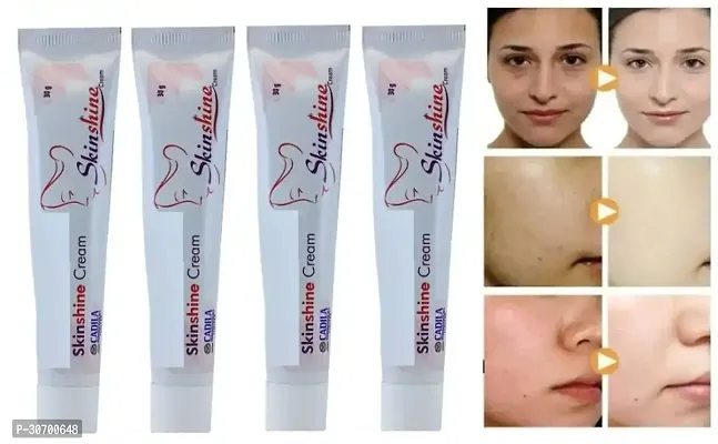 Professional Skin Shine Day Skin Whitening Cream Pack of 4.-thumb0