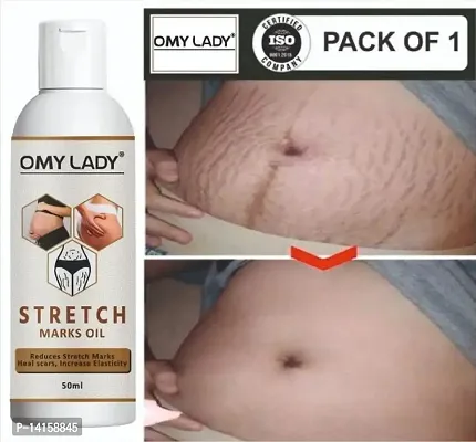 Omy Lady Stretch Marks Oil 50ml