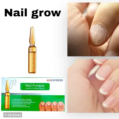 Buy Femingo Grow & Glow Nails Serum for Healthy Nails | Acetone & Alcohol  Free Nail Polish Remover | Promotes Nail Growth | Prevents Breaking Of Nails  | Manages Bacterial Infections on