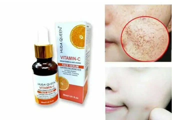 Mavles Beauty Combo of Vitamin C Face Serum for Glowing Skin