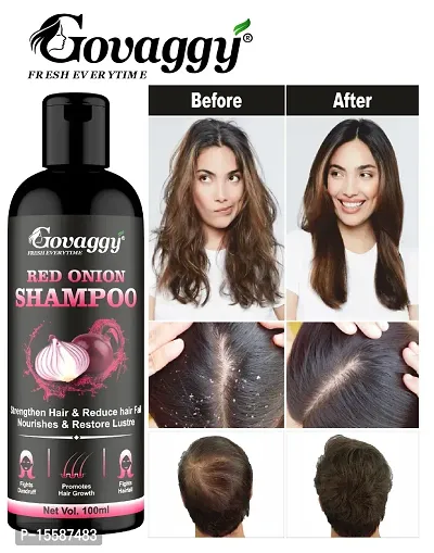 Govaggy Red Onion Shampoo For Anti-dendruf, Smooth And Nourishes Hair-thumb0