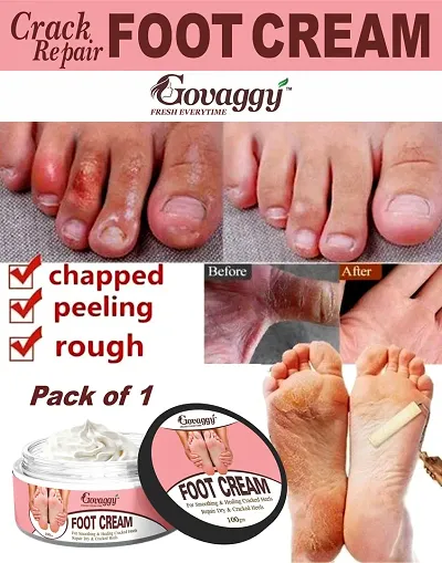Govaggy Foot Cream
