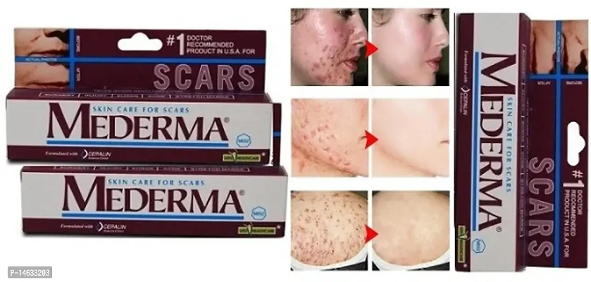 PROFESSIONAL SKIN  CARE FOR SCARS PACK OF 03