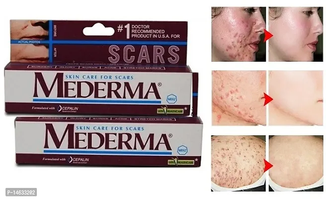 PROFESSIONAL SKIN  CARE FOR SCARS PACK OF 02-thumb0