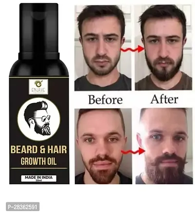 Natural Beard Care Beard Oil, 50ml, Pack of 1-thumb0