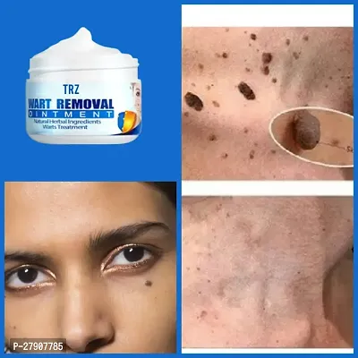New Wart Remover, Blemish Cream, Instant Blemish Removal Gel, Skin Wart Removal Cream- Effective and Scar-Free