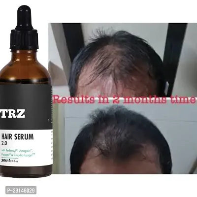 TRZ SUPER HAIR REPAIR with rosemary and ginseng root for hair growth