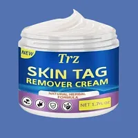 Best Skin Tag Remover Cream-thumb3