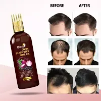 Driddle hair fall control/hair growth  hair oil 1 item in the pack-thumb1