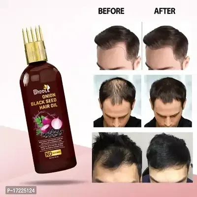Driddle hair fall control/hair growth  hair oil 1 item in the pack-thumb2