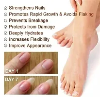 Nail Serum for Nail Growth  Repair, Fungal Infection, Anti-infective Removal Paronychia Onychomycosis 30ml-thumb2