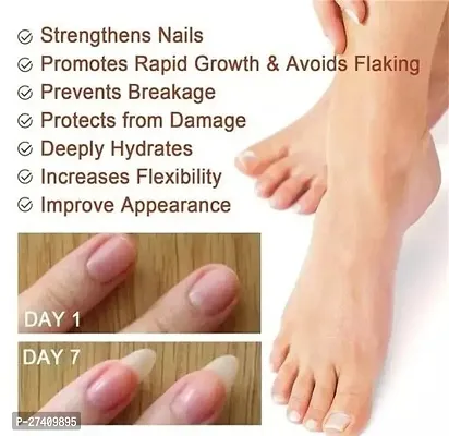 Nail Serum for Nail Growth  Repair, Fungal Infection, Anti-infective Removal Paronychia Onychomycosis 30ml-thumb3