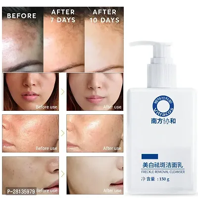 Whitening And Refreshing Freckle Removal Facial Cleanser 150 ml-thumb0