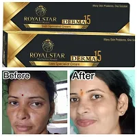 THENYN Royalstar Derma 15 Skin Specialist Cream 25g Dark Circle Remover Herbal Ayurvedic Cream-thumb2