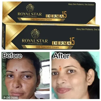 THENYN Royalstar Derma 15 Skin Specialist Cream 25g Dark Circle Remover Herbal Ayurvedic Cream-thumb3