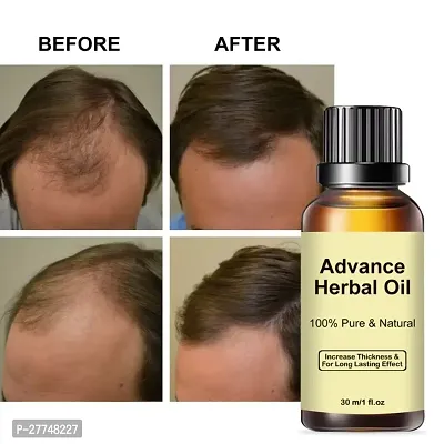 Natural Hair Care Hair Oil 30 ml
