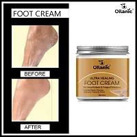 Oilanic Foot Care Cream For Dry and Cracked Heel For Repair |Healing  softening cream 100gm-thumb4