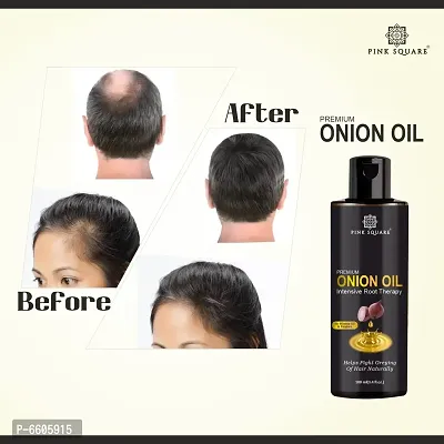 Premium Onion Oil - Intensive Root Therapy With Active Hair Growth Booster Ingredients- For Anti Hair Fall and Promotes Hair Regrowth -100 Ml-thumb0
