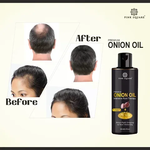 Best Quality Hair Oil For Hair Growth