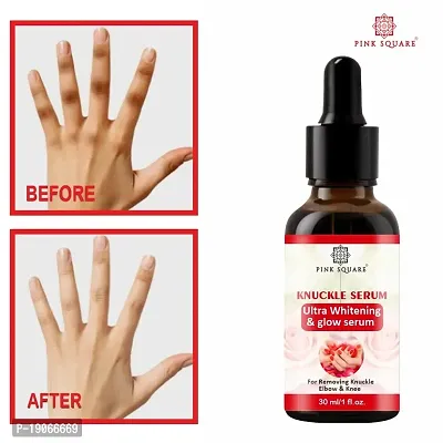 Pink Square Skin Lightening Serum to Remove Dark Knuckles from Hands, Legs, Knees, Elbows for Smooth Skin Pack of 4 of 30 ML(120 ML)-thumb3