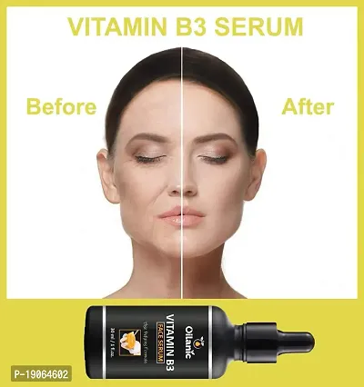 Oilanic 100% Pure  Natural Vitamin B3 Serum- For Anti-Anging  Wrinker Reducer (30 ml)-thumb3
